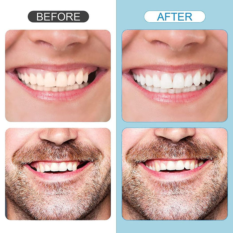 [Australia] - Tooth Repair Kit，Temporary Natural Shade for Filling The Gap, Moldable Thermal Beads Replacement Kit Replace The Missing or Broken Tooth-6PCS 