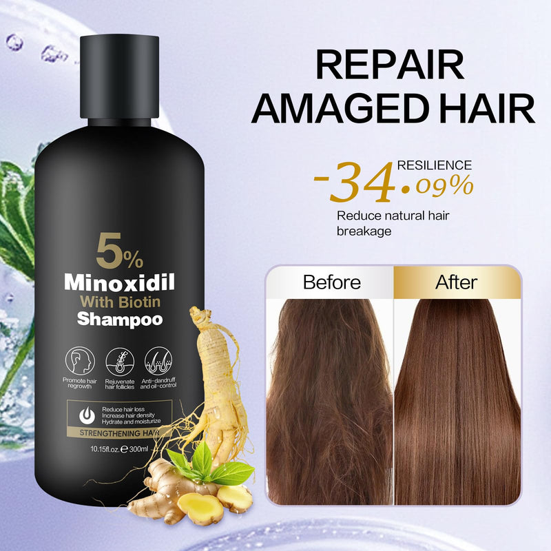 Minoxidil Shampoo & Conditioner Set for Hair Growth – Biotin, Ginseng & Ginger – Supports Thicker, Fuller Hair – Scalp Care Formula – For Men & Women – 600ml Duo
