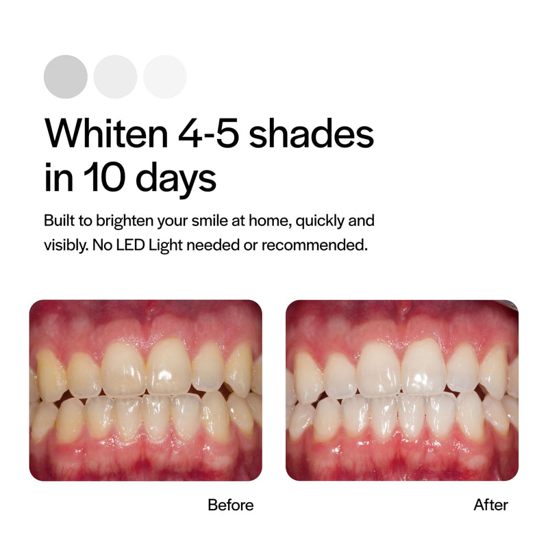 [Australia] - Opalescence Go 15% Mint - Prefilled Teeth Whitening Trays - 15% Hydrogen Peroxide - (10 Treatments) Made by Ultradent Products. Teeth Whitening Kit -Mint - Includes 2Chill Toothbrush 5194-1T 1 Count (Pack of 10) 