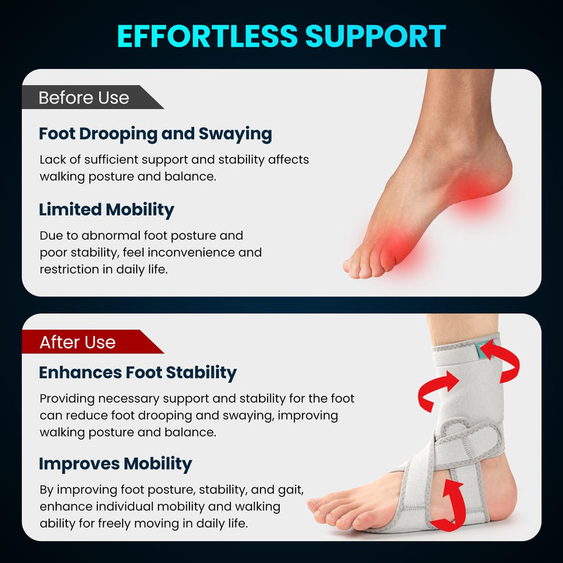 Welnove Drop Foot Brace with Arch Support, AFO Ankle Brace for Walking, Relieves Instability of Lower Limbs by Foot Drop, MS, TBI, Spinal Cord Injury, Cerebral Palsy (Right, Grey)