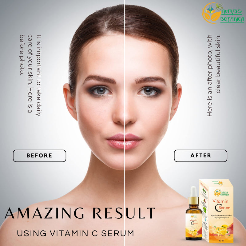 Herbs Botanica Vitamin C Serum For Face with Hyaluronic For Anti Aging Hydrating & Serum for Dark Spots, Fine Lines, Includes Vitamin E, Organic Aloe Vera and Jojoba Oil 1 fl oz Vitamin C Serum with Hyaluronic Acid