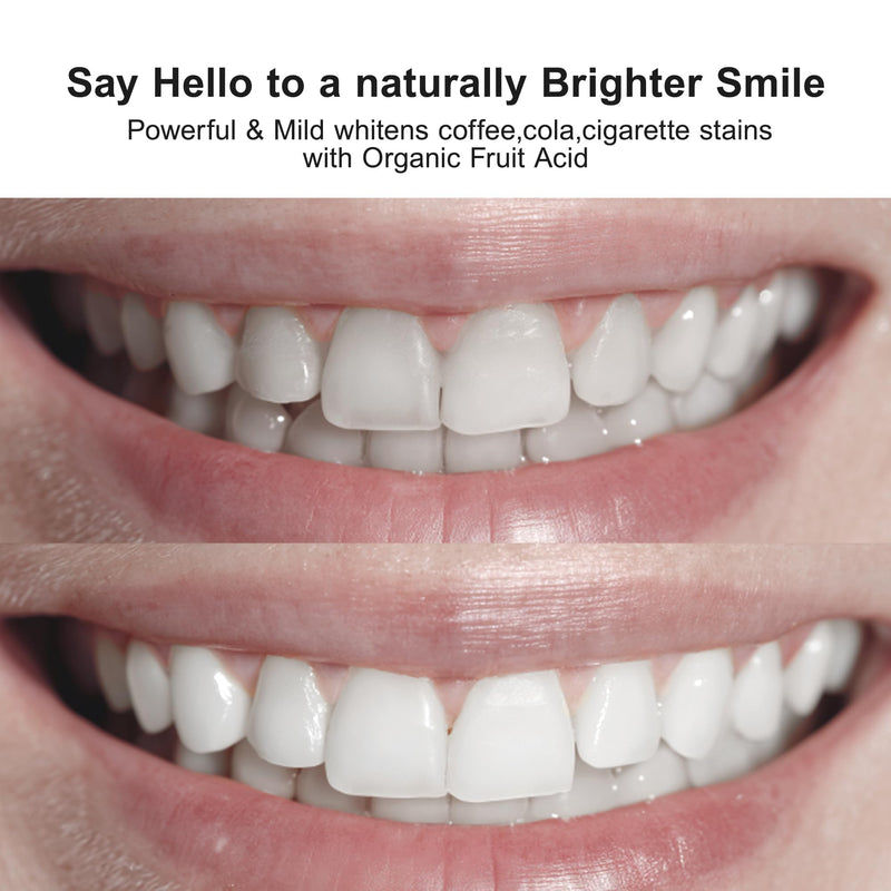 [Australia] - 1% Fruit Acid Whitening Ampoule Toothpaste with Nano hap, Gentle Enamel-Safe Brightening, Removes Stains from Coffee/Tea/Smoking, Strengthens & Protects Teeth, 3 Bottles(1.23 oz Each) 