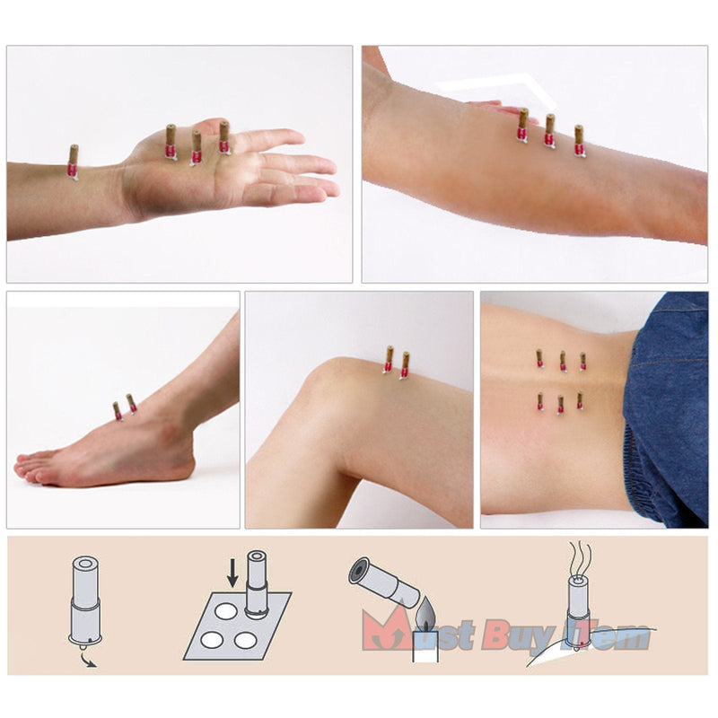 [Australia] - Korea Acupuncture 100% Wormwood Mugwort Moxibustion Mini Moxa Sticks On Cone Roll 1Box 180pcs Weak 
