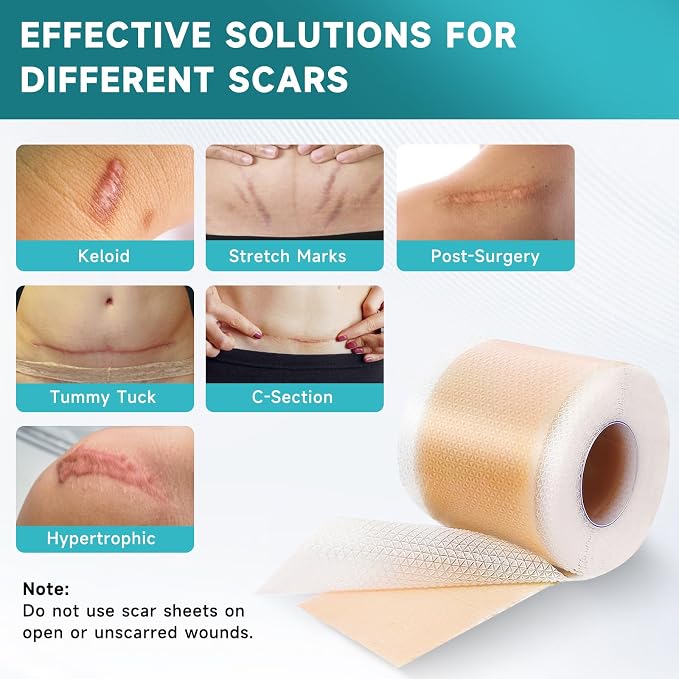 Medical-Grade Silicone Scar Tape Roll (1.6" x 118") Silicone Scar Sheets Keloid Bump Removal - Reusable Silicone Tape Scar Removal Strips, Scar Tape for Surgical Scars, C Section Scar Silicone Strips 1 Pack
