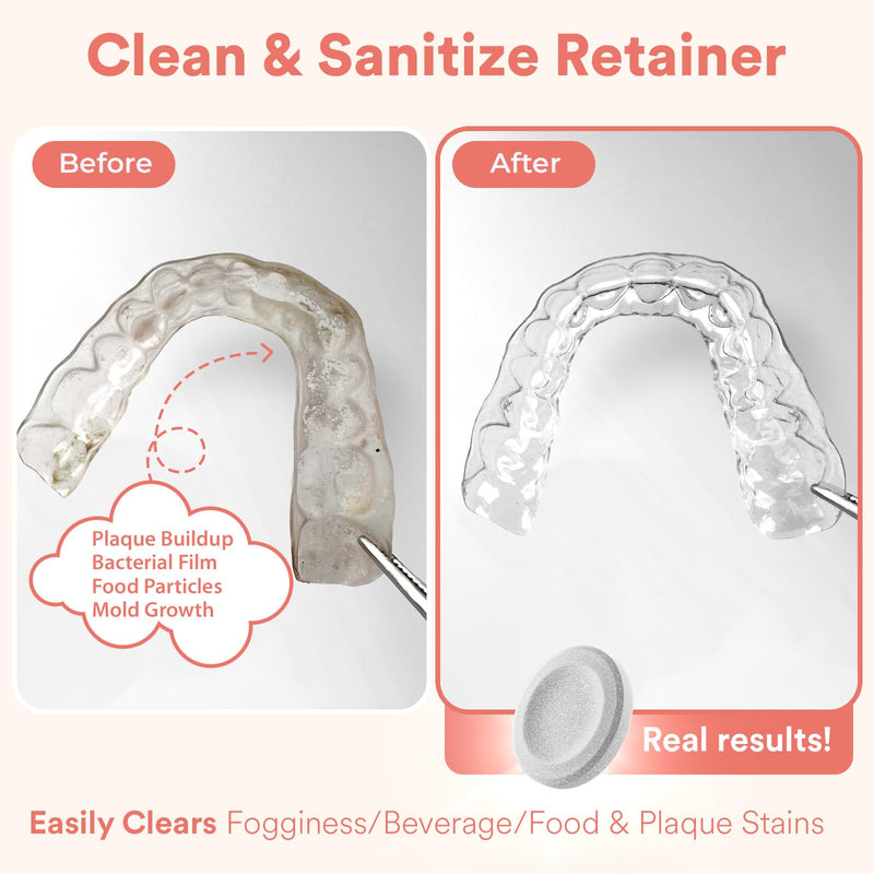 [Australia] - Weiss Naturals Retainer Cleaning Tablets, Invisalign Cleaner, Remove Stains, Odors & Plaque, FSA & HSA Eligible, Night Guard Cleaner PERSULFATE & DYE-FREE 1-Month Supply, Denture Cleaners, 30 Tablets 1 Count (Pack of 30) 
