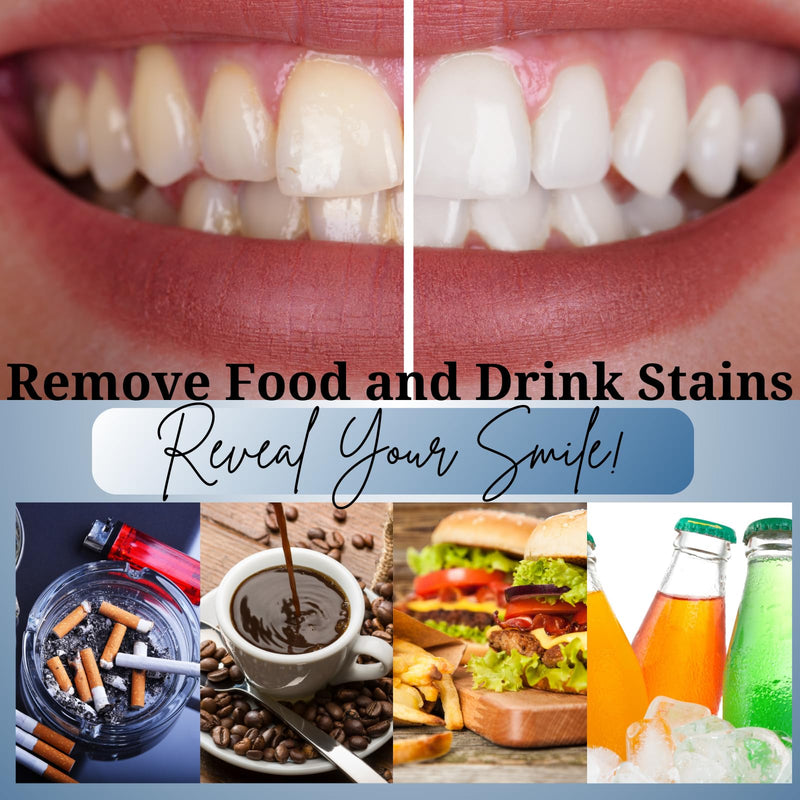[Australia] - Teeth Whitening Kit 10 Syringes Strongest 44% Carbamide Peroxide Vegan Teeth Whitening Gel, Light and Teeth Bleaching Trays Included 