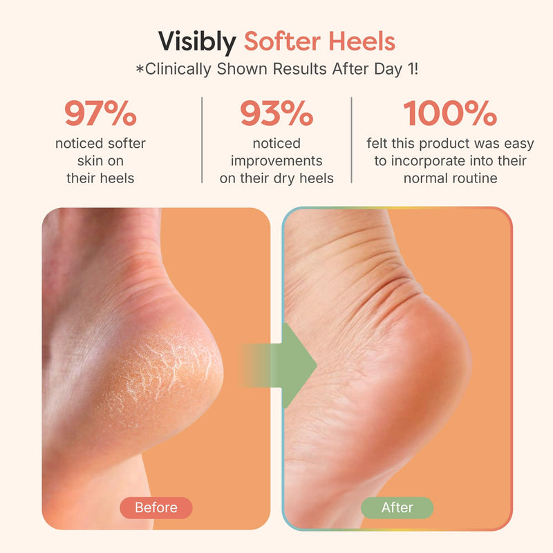 [Australia] - ZenToes Foot Care Kit – Exfoliating Foot Mask for Dry Cracked Feet with Urea, Niacinamide & Rose Extract (3 Pairs) + Hydrating Heel Socks with Vitamin E and Olive Oil (Fuzzy Pink) 
