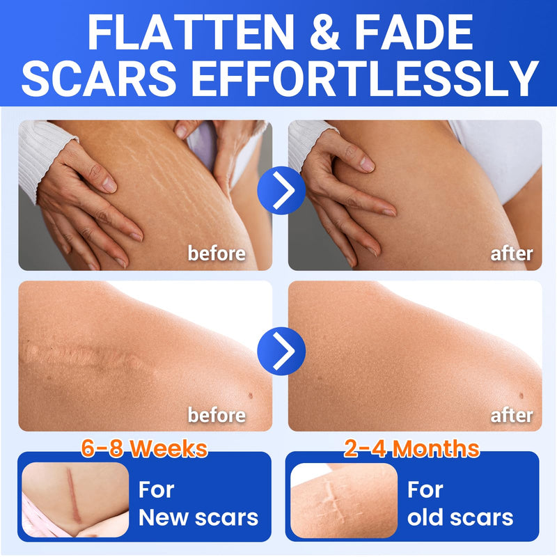 [Australia] - Silicone Scar Sheets Medical Grade Tape (1.6"x60" Roll), Healing Patches for C-Section, Keloid, Face Wrinkles, Stretch Marks, Surgical Recovery, Professional Scar Cover for Sensitive Skin, Soft Tissue 1.6"X60‚Äú 
