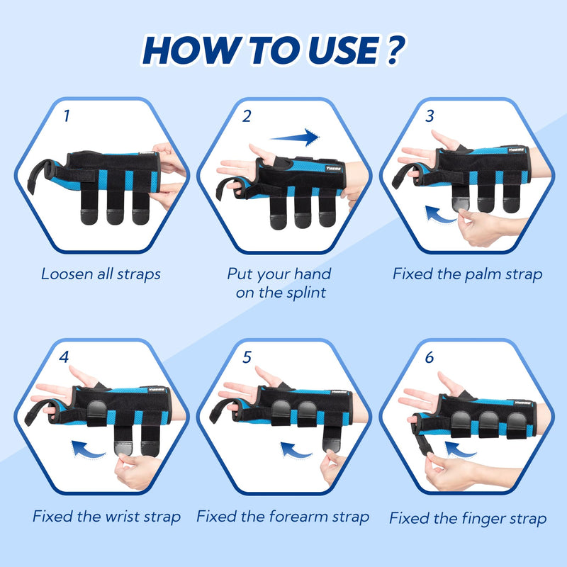 [Australia] - Boxer Fracture Splint, Ulnar Gutter Splint Right Hand, the 4th and 5th Metacarpal Finger Splint Hand Brace, Boxer Orthosis Hand & Wrist Brace for Women & Men, Right, M 