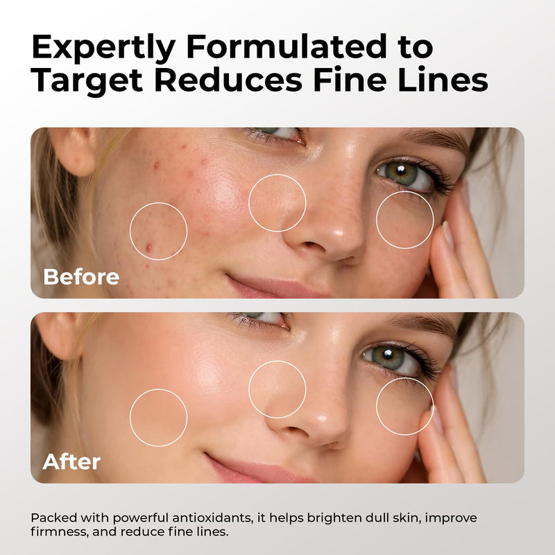 Skin Deva 10% Vitamin C Serum with Vitamin E & Ferulic Acid – Brightening Facial Serum with Hyaluronic Acid, Lightweight Formula for Even-Looking Skin - Pack of 2 2 Fl Oz (Pack of 1)