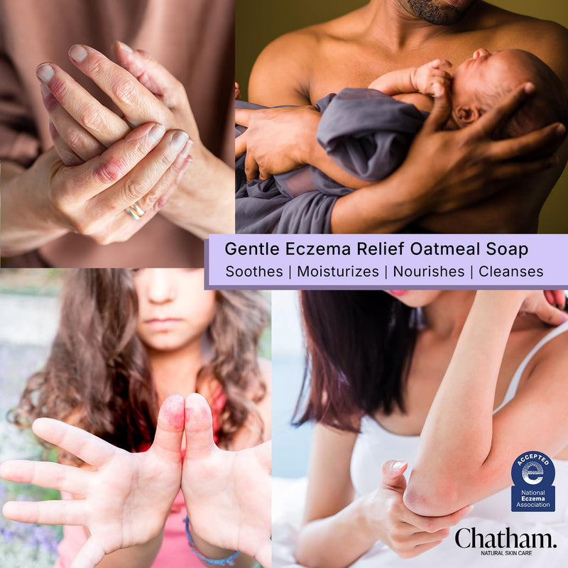[Australia] - Chatham Natural Skin Care Eczema Relief Oatmeal Soap, oatmeal bath, treatment for eczema rosacea, psoriasis 1 