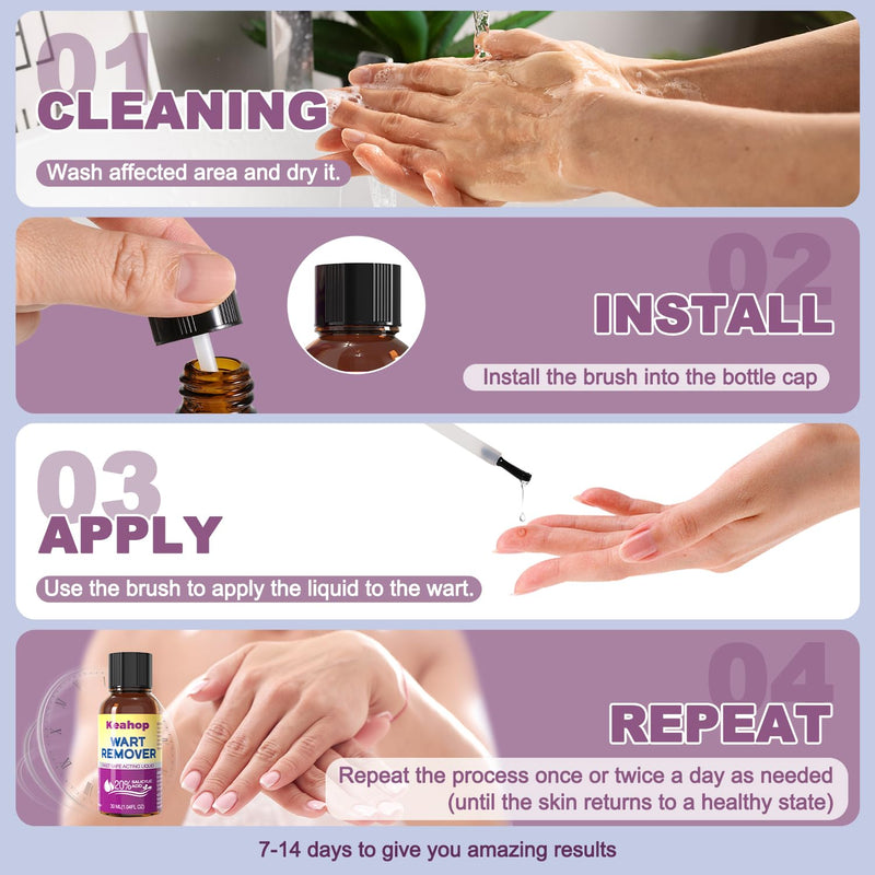 [Australia] - Liquid Wart & Corn Gel 30 ml, Maximum Strength Salicylic Acid Wart Liquid Fast-Acting for Plantar, Common and Flat,Safe for Children and Adults,1.04oz 