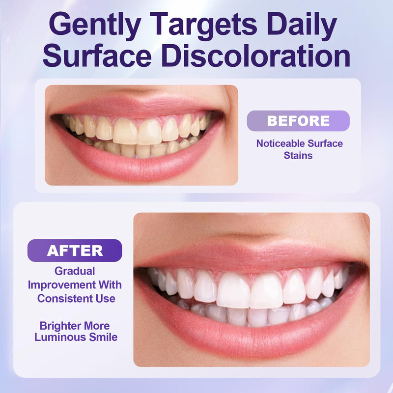 Purple Teeth Whitening Strips, 2 Pack | Gentle Daily, Surface Stain Reduction, Natural Shine, Portable, For Use at Home Or On The Go