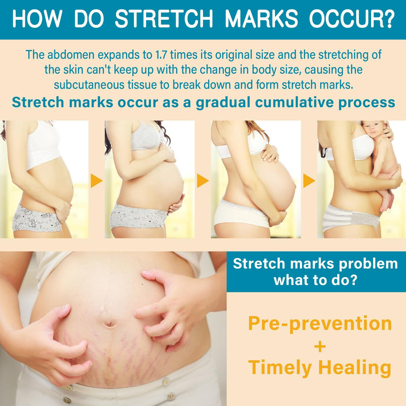 [Australia] - PEGO Stretch Mark Oil for Pregnancy, Maternity Body Oil for Stretch Mark Prevention & Reduction, Hydrating Skin Care, 5.41oz (Oil+Cream) Oil+Cream 