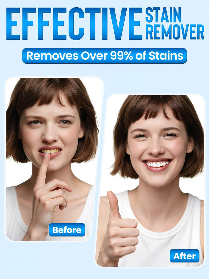 [Australia] - Teeth Whitening Kit for Sensitive Teeth: Nicwell LED Light +35% Carbamide Peroxide Whitening Gel & 1 Desensitizing Pen - Dental Grade Results - Overnight Daily-use Aged 25-35 with Travel Case 