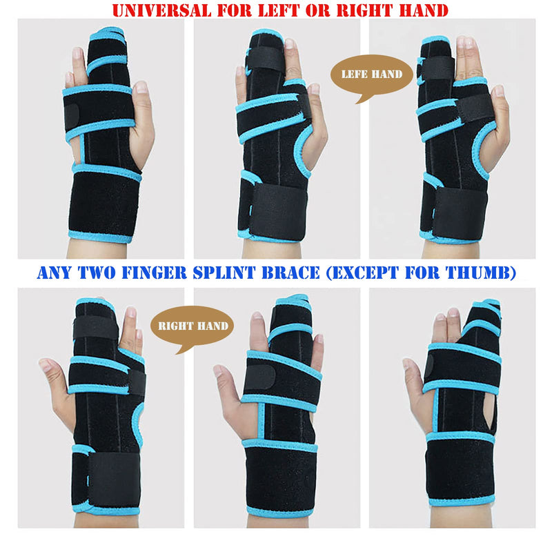 2 Finger Splint Brace Hand Wrist Support Universal for Left or Right Hand Two Trigger Finger Splint Adjustable Finger Straightening Immobilizer for Boxer Fractures, Arthritis, Mallet Finger, Sprains, Metacarpal Fractures, Broken Fingers Pain Relief