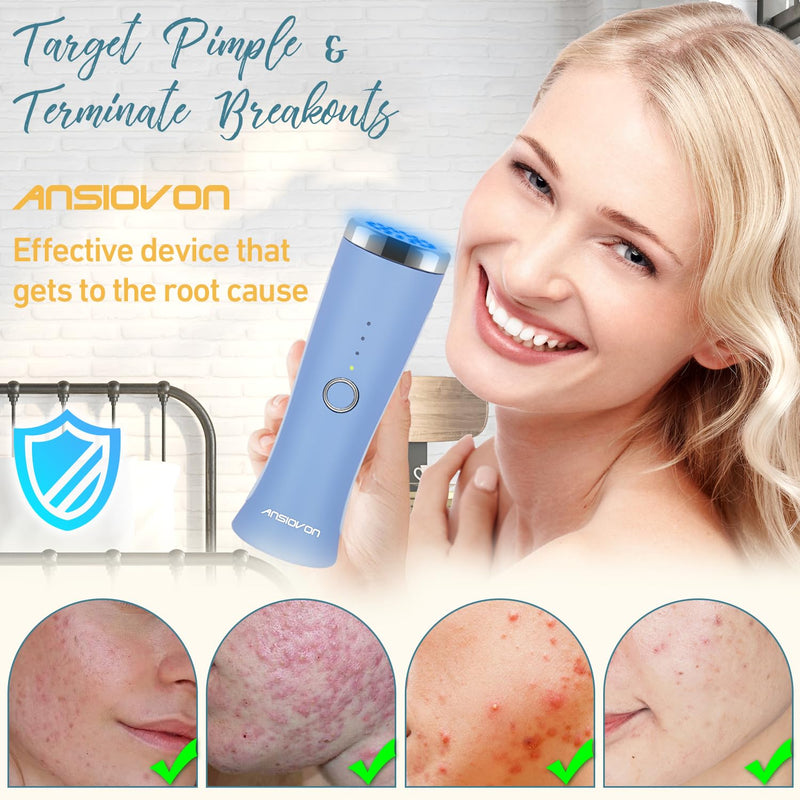 [Australia] - Blue Light Therapy Device for Acne Spot Treatment - LED Acne Blue Light Therapy Wand for Face 