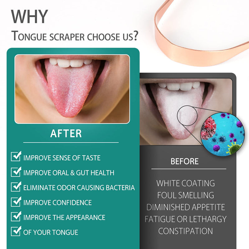 [Australia] - RONAVO Copper Tongue Scraper for Adults (2 Pack), 100% Pure Copper, Naturally Anti-Microbial, Banishes Bad Breath and Maintains Oral Hygiene, Tongue Cleaner with Travel Case, Easy to Use and Clean 