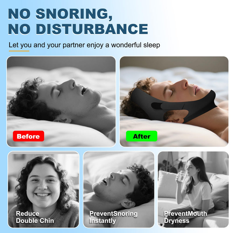 [Australia] - Chin Strap for Sleeping, Adjustable Chin Strap for Snoring, Anti Snoring Devices Breathable and Reusable, Comfortable Stop Snoring Solution, Anti Snore Chin Strap for Men and Women (Black) Black 