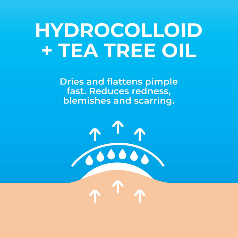 [Australia] - KEYCONCEPTS Pimple Patches for Face (120 Patches), Hydrocolloid Acne Patches with Tea Tree Oil, Pimple Patch Pimple Stickers - Hydrocolloid Patch Acne Dots - Acne Pimple Patches For Face - Zit Patches Hydrocolloid and Tea Tree 1 Count (Pack of 120) 