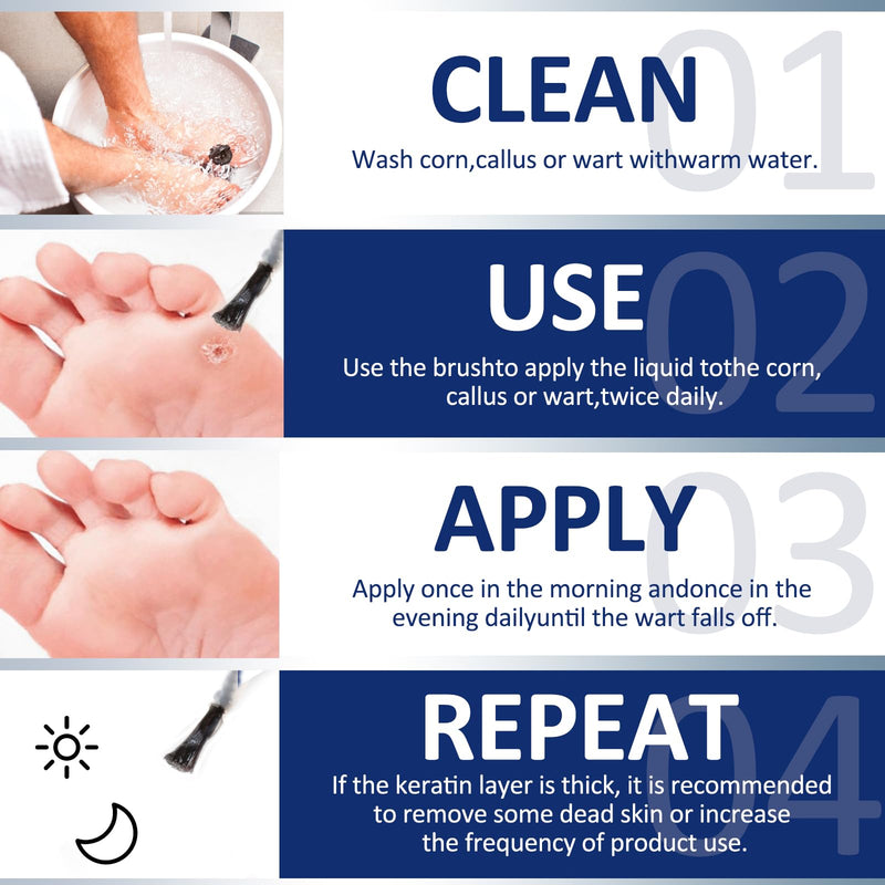 [Australia] - LIQUID WART&CORN REMOVER, 15ml wart remover, solution against corns and calluses, corn remover, wart remover, corn relief from corn pain and foot care, wart removal 