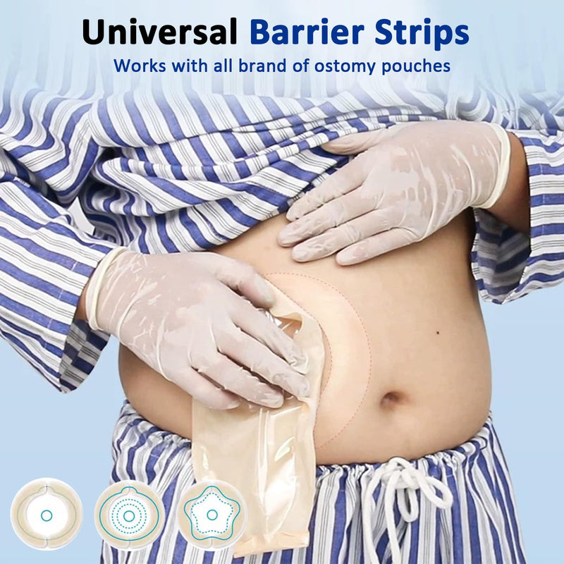 [Australia] - 30PCS Ostomy Barrier Strips, Medical Hydrocolloid Ostomy Supplies, Elastic Barrier Strips, Waterproof Leak-Free Skin Adhesive Barrier Tapes for Stoma Colostomy Bags 