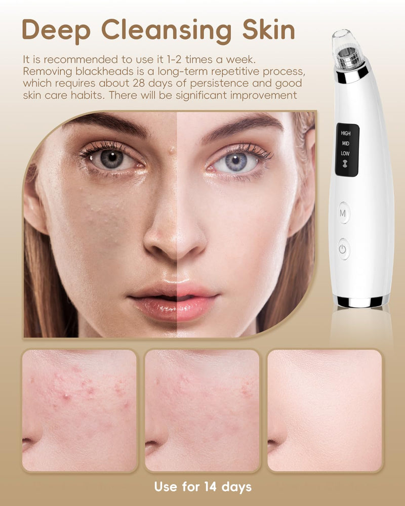 Facial Pore Blackhead Remover Vacuum - Fore Cleaner and Blackhead Extractor with 3 Adjustable Suction Levels - 5 Probes - Pore Vacuum Kit for Women&Men (White) White