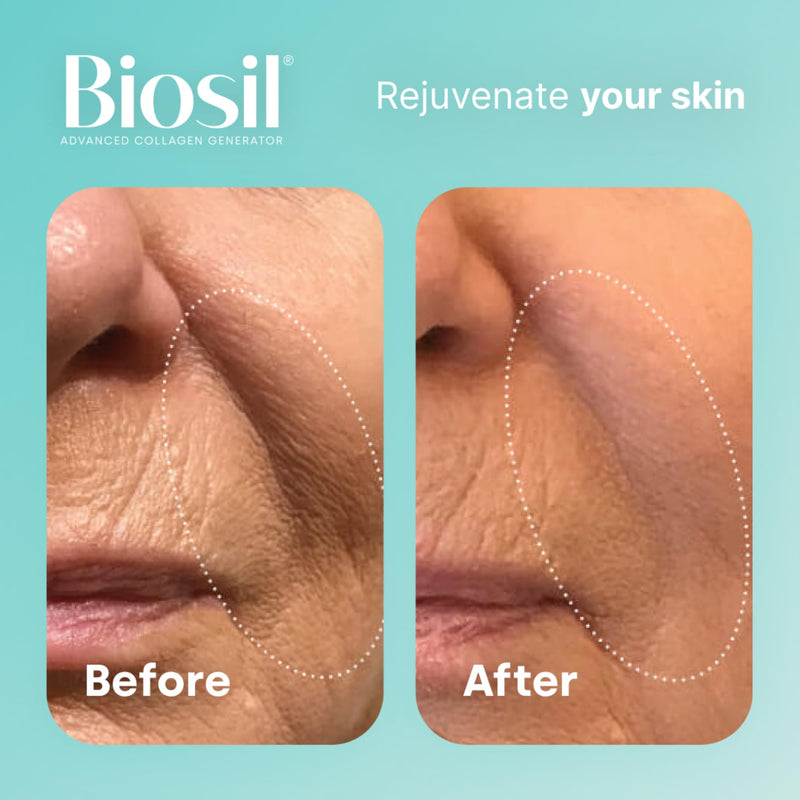 [Australia] - Biosil Collagen Generator - 120 Capsules - with Patented ch-OSA Complex - Generates & Protects Your Own Collagen - GMO Free - 120 Servings 1 Count (Pack of 120) 