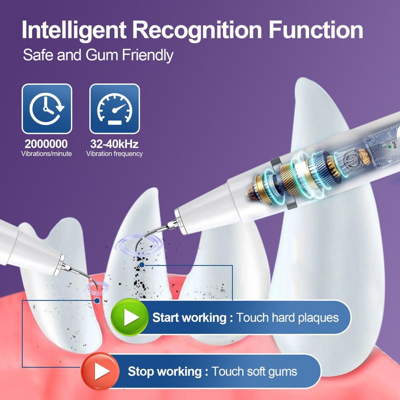 Dog Teeth Cleaning Kit-Dog Tooth Plaque Remover-Ultimate Pet Dental Care Kit - Ultrasonic Teeth Cleaner and Plaque Remover for Dogs | Complete Oral Hygiene Solution-White White