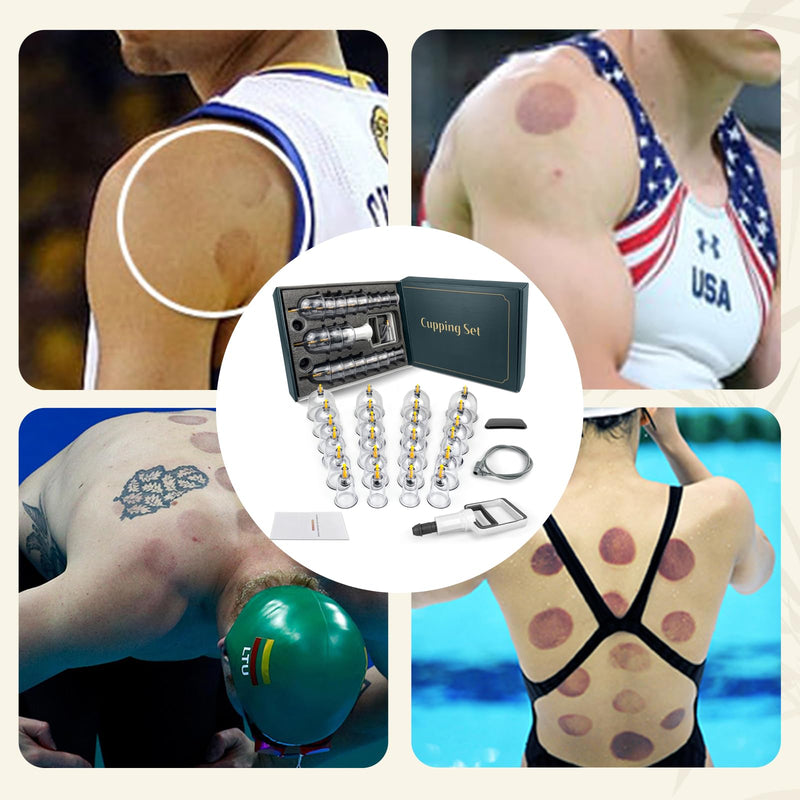 Cupping Kit for Massage Therapy - 24 Cups Professional Massage Cups Set with Manual Pump, Vacuum Cupping Therapy Set for Cellulite Reduction Muscle Pain Relief 24 Cups Green Box