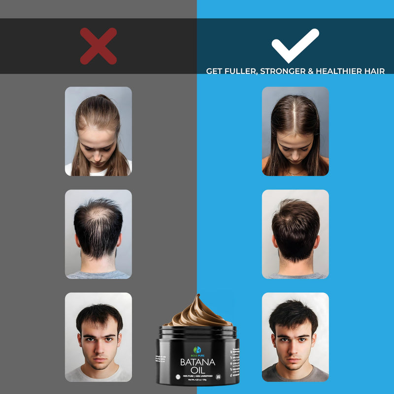 [Australia] - Premium Raw Batana Oil ‚Äì Pure & Unrefined - Advanced Hair Regrowth & Scalp Therapy Device - Supports Fuller, Healthier Hair & Skin - For Men & Women, 4.23 OZ 
