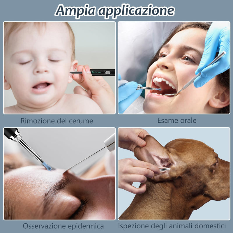 [Australia] - Earwax Remover Otoscope, Ferdiiz 1080P Ear Cleaner with Camera, IP67 Waterproof Ear Cleaning for iPhone, iPad and Android Smartphones.(Black) Black 1 
