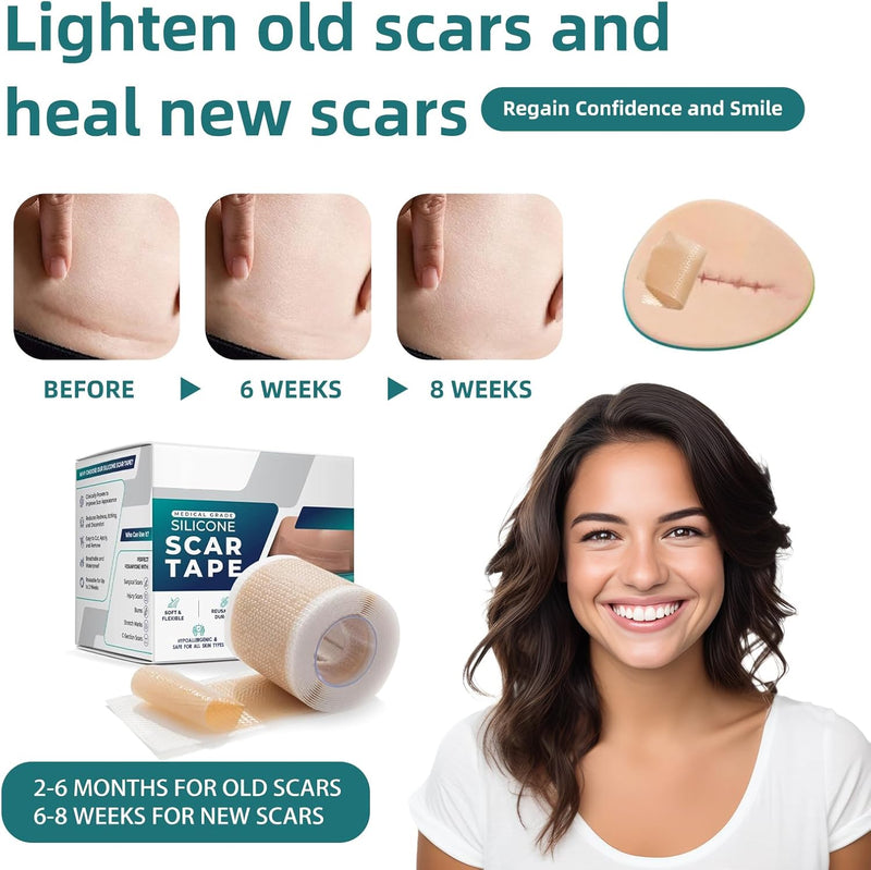 [Australia] - Silicone Scar Sheets, Silicone Scar Tape(1.6”x 60” Roll-1.5M), Silicone Scar Strips, Professional Scar Removal Sheets for Surgical Scars, Keloid, C-Section, Burn et 