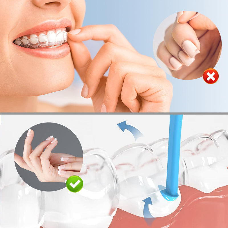 [Australia] - Aligner Removal Tool, 10 Invisible Braces Removal Tools, Retainer Remover Tool, Suitable for Removing Braces, Trays, Retainers, Dentures and Aligners(Blue). Regular size B 10pcs Light blue 
