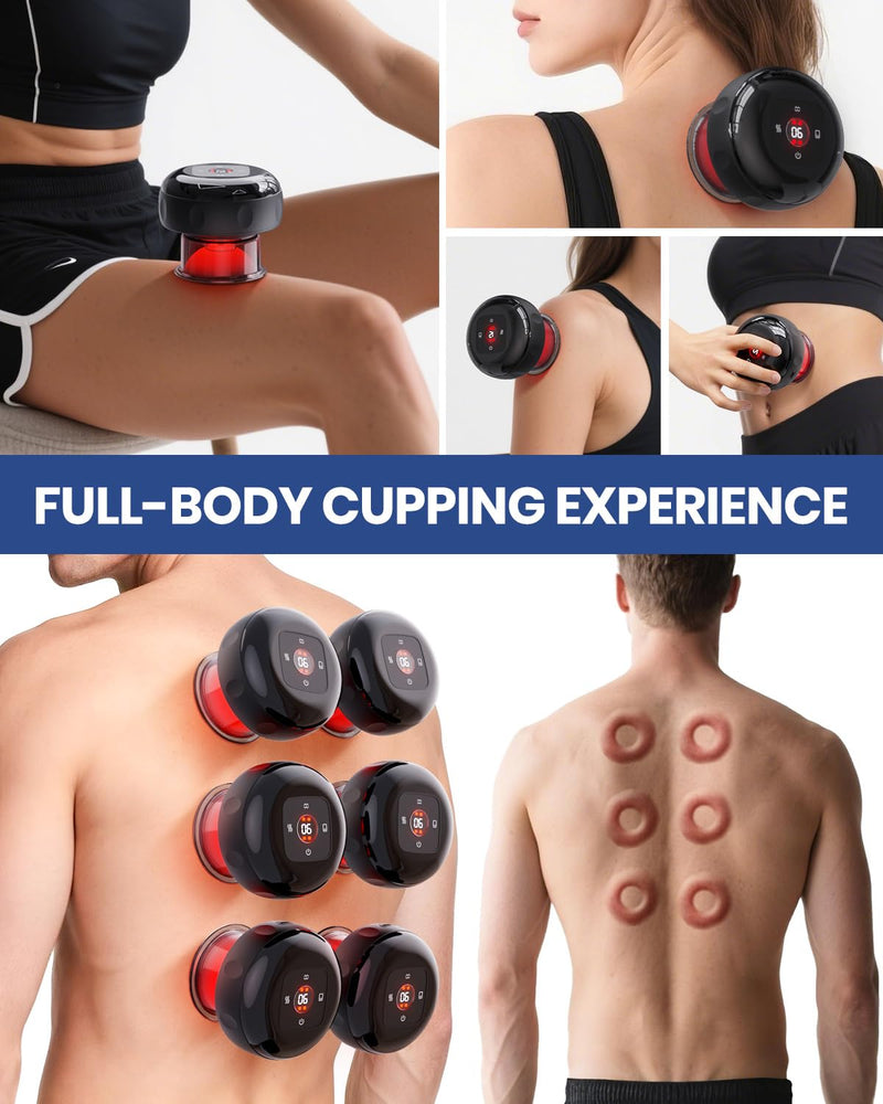 EURPMASK Choose the color of europe Electric Cupping Set with Red Light - 24 Levels Adjustable Suction & Heat, One-Touch Control, Portable Muscle Relaxation Tool 2 Pack