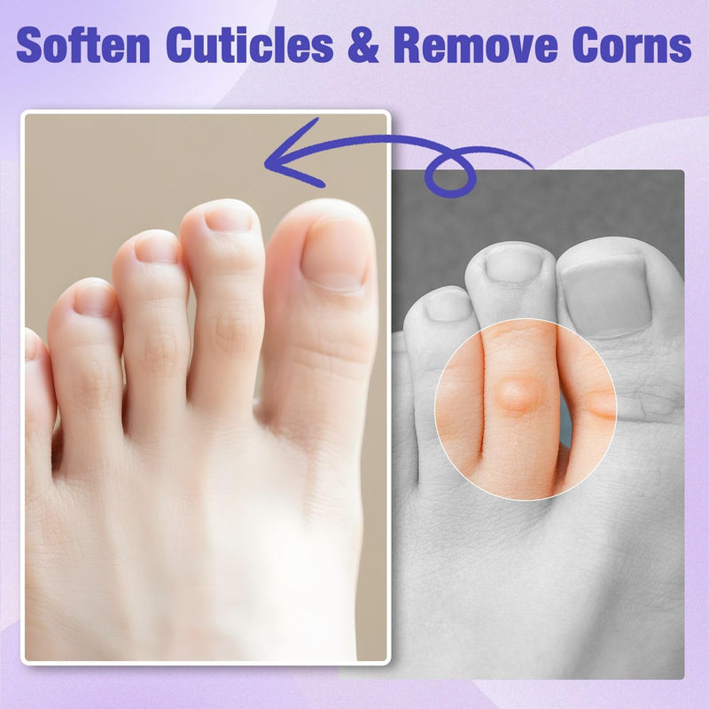 [Australia] - 40% Salicylic Acid Corn Removers Pads for Feet & Toes - Max Strength Medicated Treatment - Fast-Acting Adhesive Targets Corns, Calluses & Dead Skin - 30 Count 30 Count (Pack of 1) 