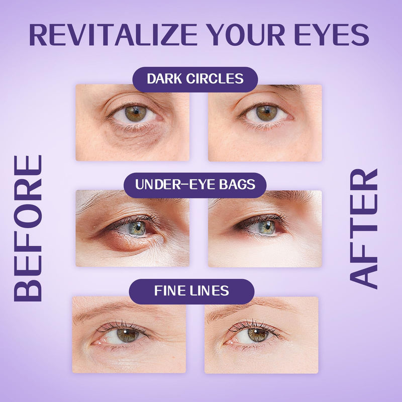 Caffeine & Retinol Vitamin A Eye Serum, Fast Absorbing Under Eye Serum for Puffy Eyes, Dark Circles, Fine Lines & Wrinkles, Hydrating Daily Eye Care 1