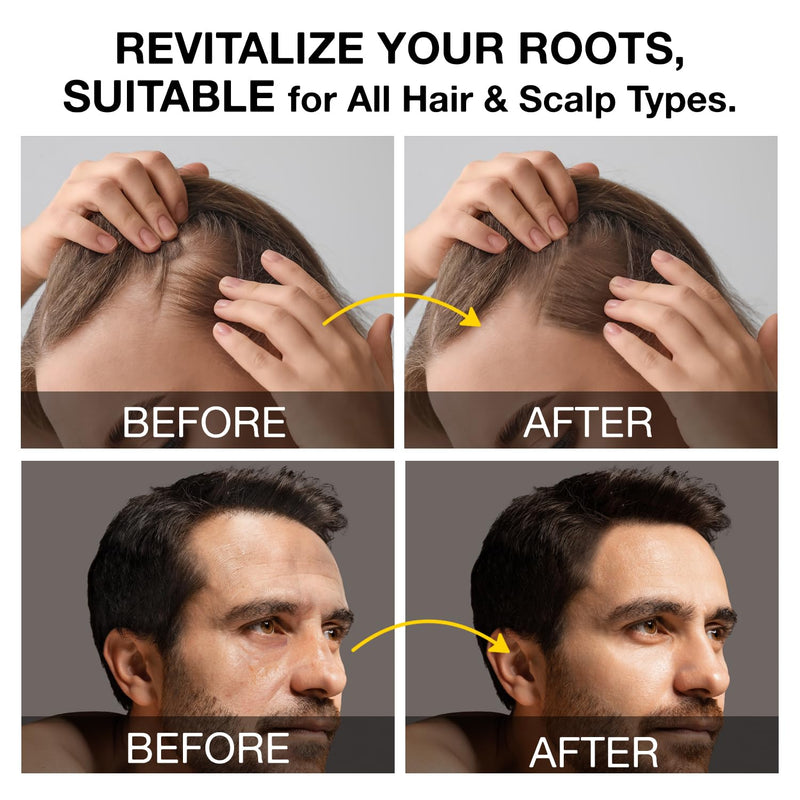 Root Activator Shampoo for Men: Hair Growth Shampoo for Hair Loss and Thinning Hair - 10.1 fl oz / 300 mL Root Activator Shampoo 10.1 Fl Oz (Pack of 1)