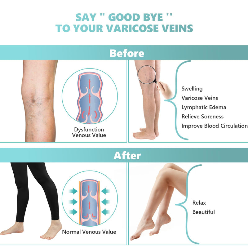 [Australia] - Compression Pantyhose for Women, 20-30 mmHg Footless Medical Compression Stockings, Waist High Opaque Graduated Support Compression Hose Tights for Edema, Varicose Veins, Swelling X-Large Black 