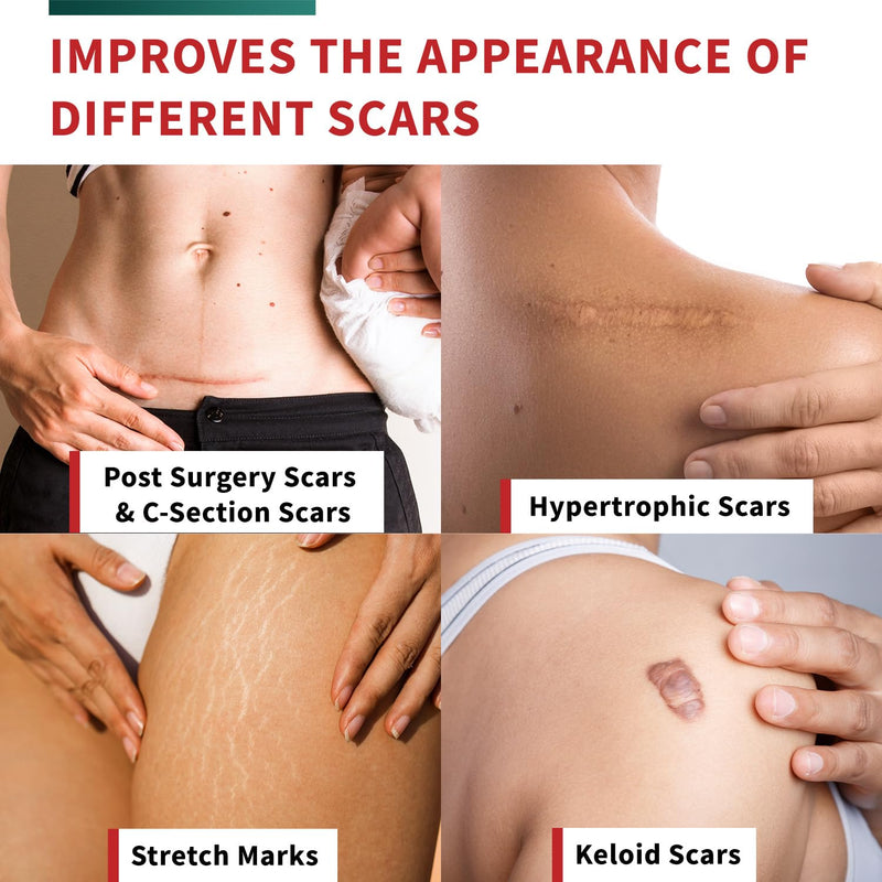 [Australia] - Medical-Grade Silicone Scar Tape Roll (1.6" x 118") Silicone Scar Sheets Keloid Bump Removal - Reusable Silicone Tape Scar Removal Strips, Scar Tape for Surgical Scars, C Section Scar Silicone Strips 1 Pack 