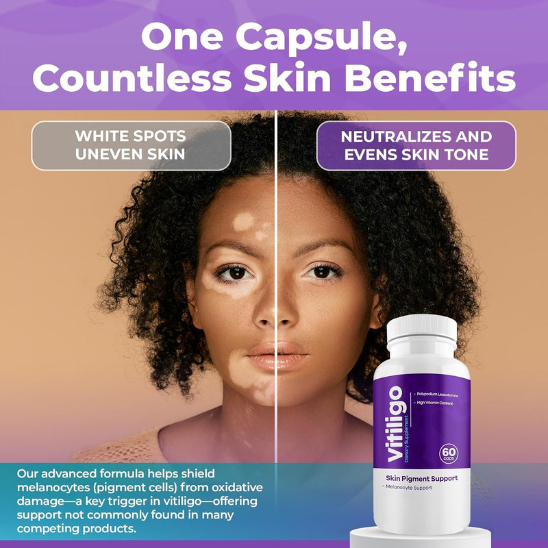 Vitiligo Capsules 60 Count | 1 Month | Improve Skin Pigmentation Support and Reduce White Spots | Effective Vitiligo Supplement | Natural Solution for White Spots on Skin. (2) 2