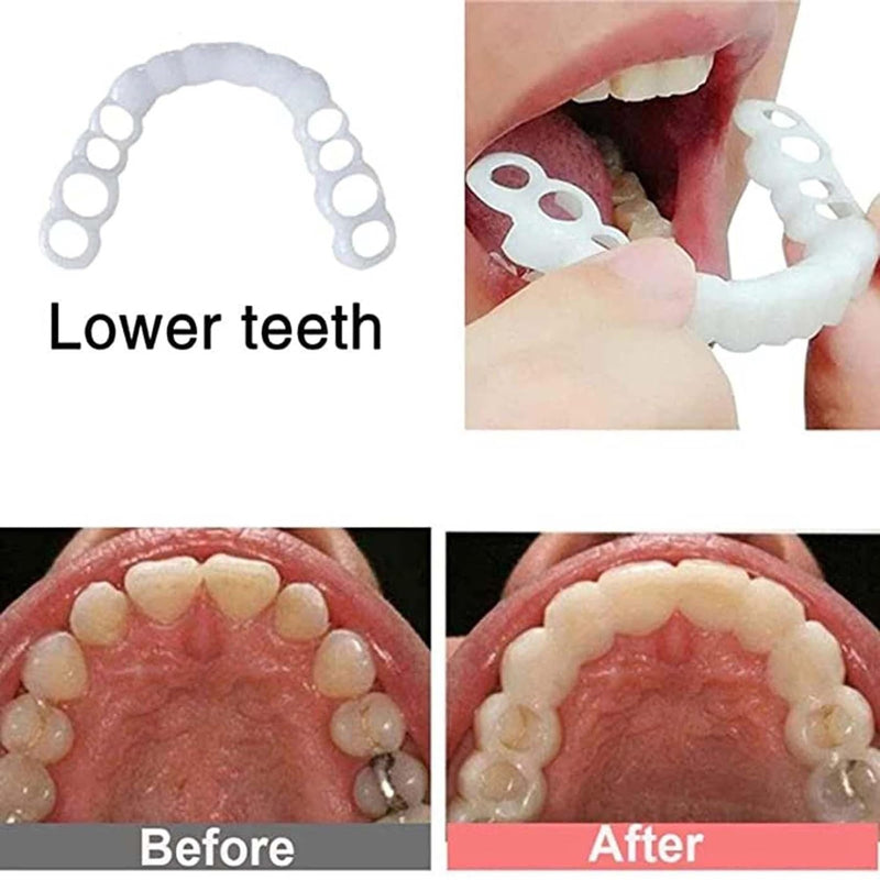 2 Pairs,Temporary Smile Solution, Adjustable & Comfortable.(White) (2)