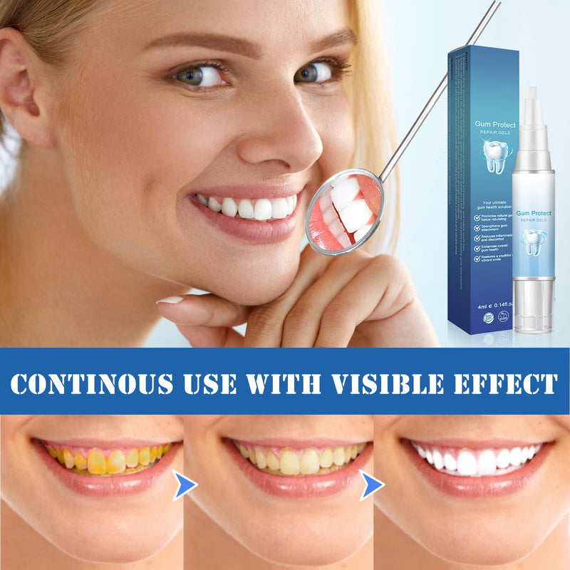 [Australia] - Neslemy™ Gum Shield Therapy Gel, Neslemy Gum Gel, Dentizen Gum Therapy Gel, Teeth Whitening Essence Pen, Gum Instant Treatment Gel, pack of 3 A 