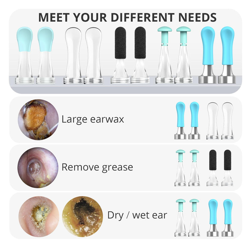 BEBIRD Official Replacement Tips for R1 Ear Camera - 10 PCS Ear Wax Removal Tips for Wet/Dry Earwax Cleaning - Ear Spoons Accessories Set for BEBIRD T15/W3/R3/X3/D3Pro/M9/R1 (Spiral Structure!)