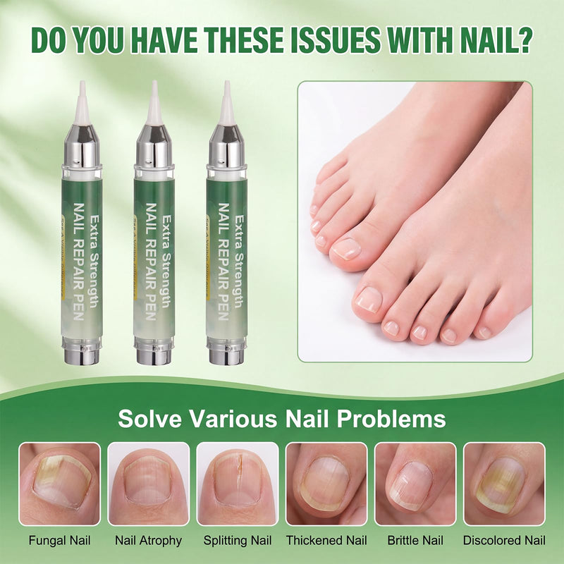 High capacity Nail Pen-16 ml per unit,Toenail Pen Treatment