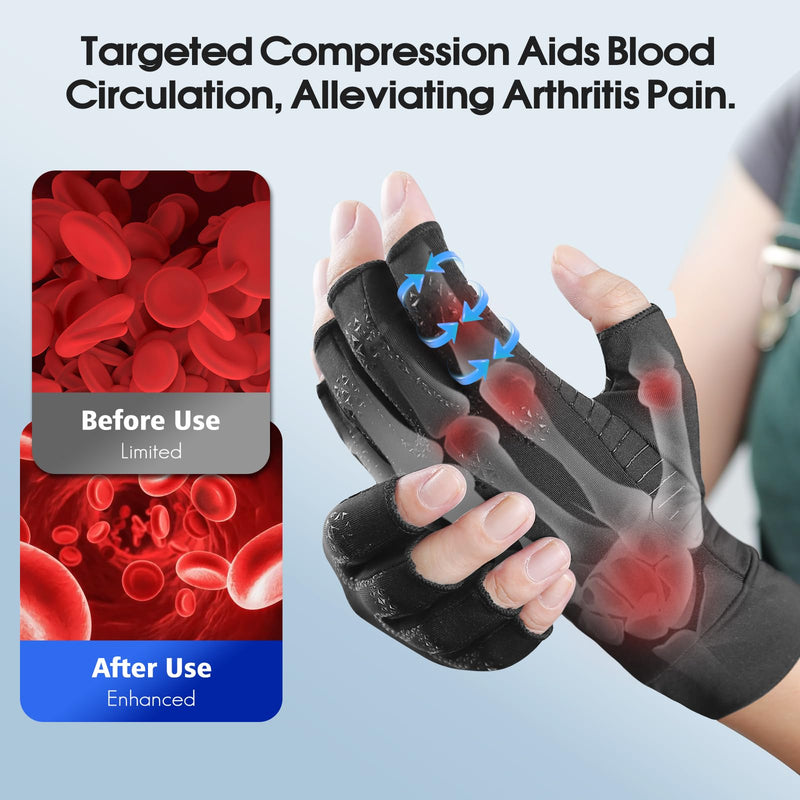 Donfri 2 Pairs Copper Arthritis Compression Gloves Women Men Black (XL) Black (2 Pairs) X-Large
