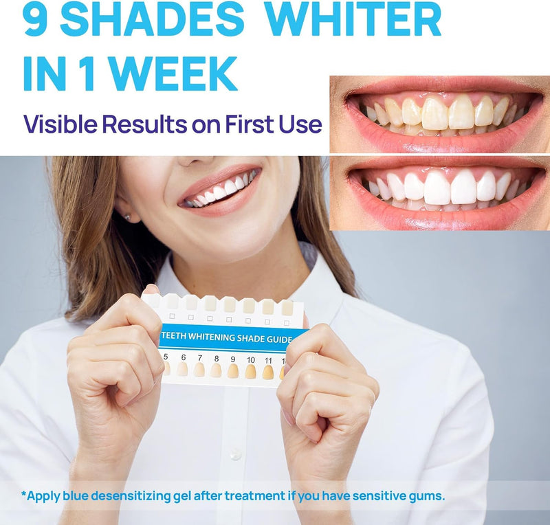 [Australia] - Upgraded Teeth Whitening Kit with Pens for Sensitive Teeth: Teeth Whitening LED Light, Mouth Tray, Carbamide Peroxide Whitening Gel - Fast Teeth Whitener and Tooth Stain Remover Spearmint 