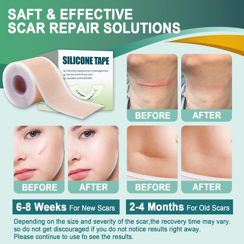 [Australia] - Silicone plaster for scars, professional scar plaster, reusable (4cm x 150cm) 4cm x 150cm 