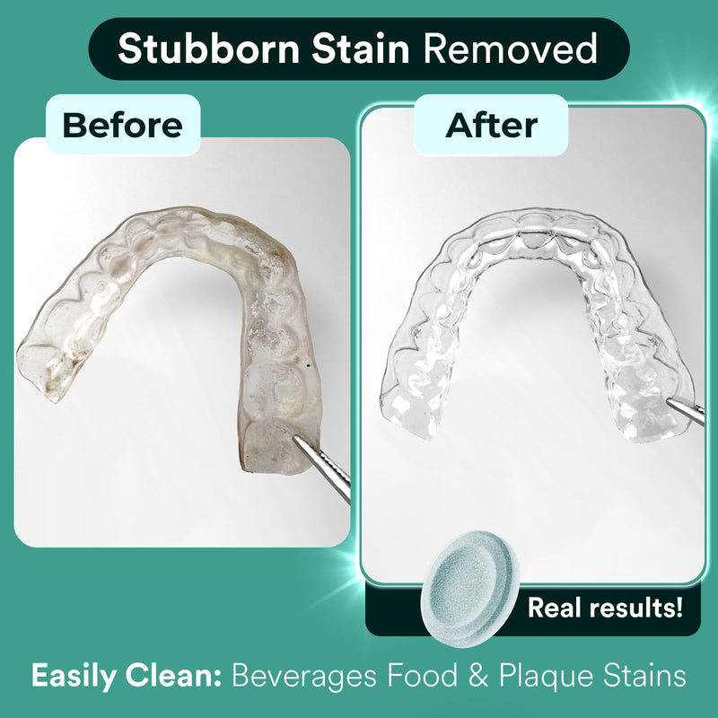 [Australia] - Retainer Cleaner Tablets, Invisalign Cleaner, Remove Stains, Odors & Plaque, Night Guard Cleaner, FSA & HSA Eligible, 1-Month Supply of PERSULFATE-FREE Denture Cleaner, 30 Tablets, Mint-Scented 