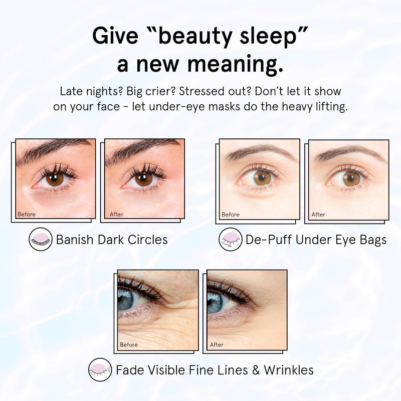 [Australia] - grace & stella Purple Eye Treatment Gels - Dermatologist Tested - Under Eye Masks With Retinol - Restoring Under Eye Patches for Puffy Eyes and Dark Circles - Vegan, Cruelty-Free, 24 Pairs 